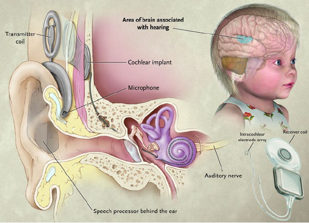 Developing Advanced Neuroprosthetics for Restoring Sensory Perception and Motor Control