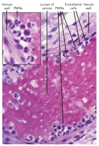 inflammation