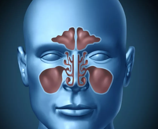 Chronic Bacterial Sinusitis can be Prevented by Daily Nasal Rinsing with Saline Solution, Study Finds