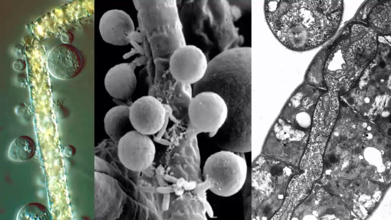 Classifying the Enigmatic: Identifying a Newly Discovered Fungus Among the Fungal Kingdom